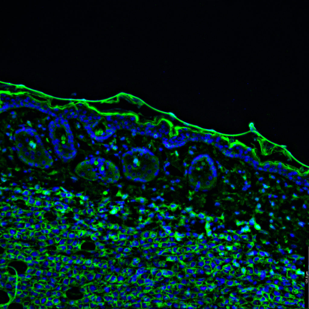Snapshot What is Immunofluorescence? National Ataxia Foundation