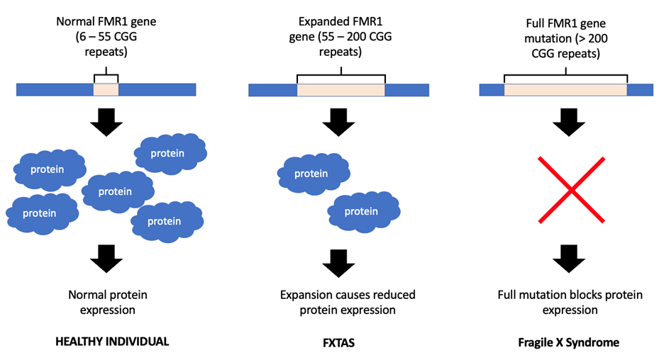 Snapshot What Is Fragile X associated Tremor ataxia Syndrome FXTAS 